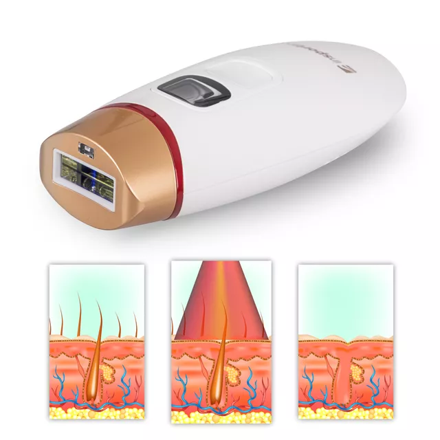 Depilator laserowy IPL inSPORTline Eriva ∙ 5 poziomów ∙ 400 000 błysków ∙ długość fali 510–1100 nm ∙ okulary + tryb automatyczny